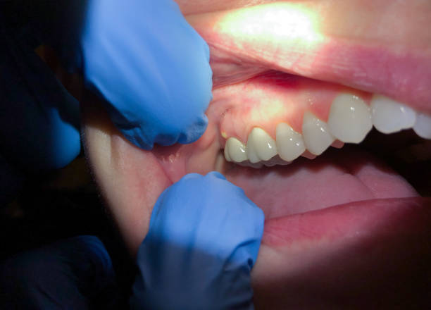 Best Knocked-Out Tooth Emergency  in Harrisville, UT
